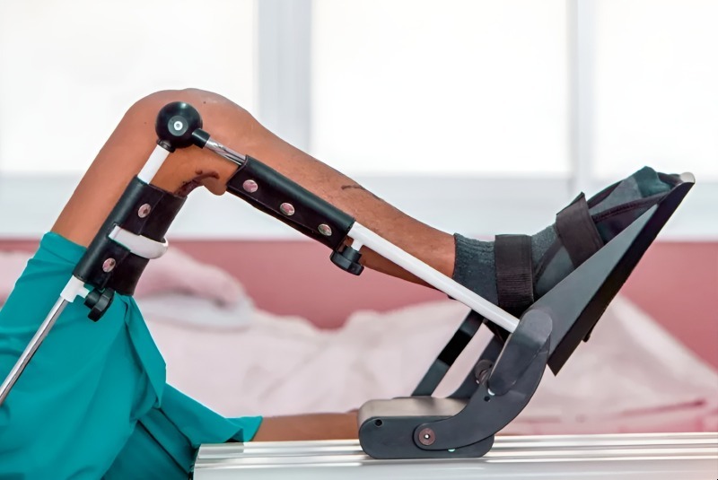 CPM Machine Sales & Rental in Del Mar